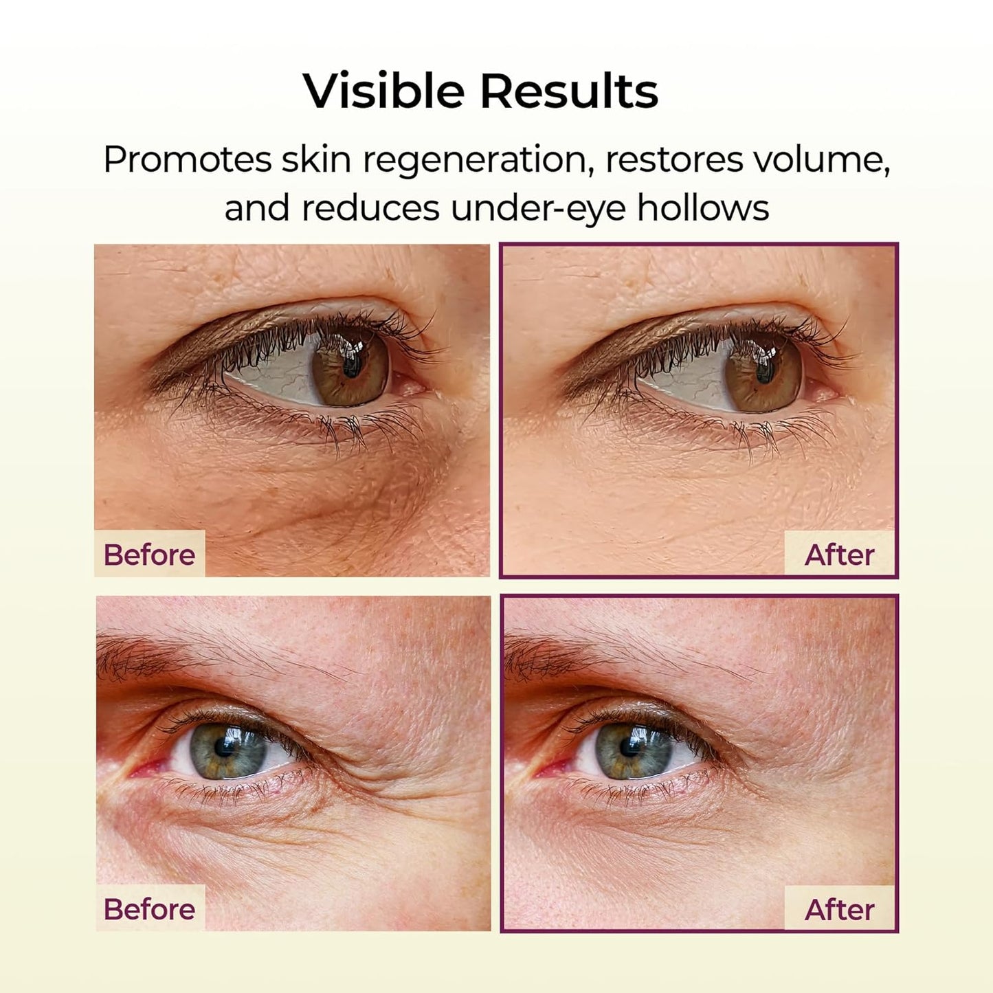 Dr.Melaxin Cemenrete Calcium Multi Balm 9g Korean Skin Care All In One Calcium Volume Stick Collagen Wrinkles Face Eye treatment Balm